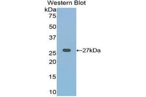Western Blotting (WB) image for anti-Frizzled Family Receptor 1 (Fzd1) (AA 117-322) antibody (ABIN1858933) (FZD1 antibody  (AA 117-322))