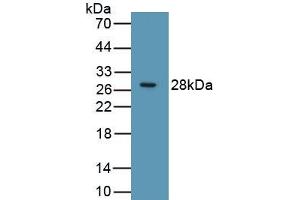 Detection of Recombinant RIPK3, Human using Polyclonal Antibody to Receptor Interacting Serine Threonine Kinase 3 (RIPK3) (RIPK3 antibody  (AA 1-217))