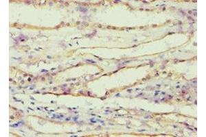 Immunohistochemistry of paraffin-embedded human kidney tissue using ABIN7143685 at dilution of 1:100 (AKR1B1 antibody  (AA 1-316))