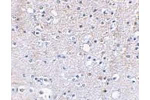 Immunohistochemical staining of human brain tissue using AP30386PU-N Grik5 antibody at 2. (GRIK5 antibody  (C-Term))