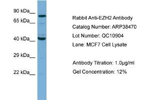 WB Suggested Anti-EZH2 Antibody Titration: 1. (EZH2 antibody  (N-Term))