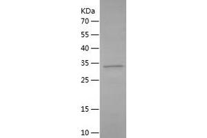 Western Blotting (WB) image for Complement Component (3d/Epstein Barr Virus) Receptor 2 (CR2) (AA 1-70) protein (His-IF2DI Tag) (ABIN7122468) (CD21 Protein (AA 1-70) (His-IF2DI Tag))