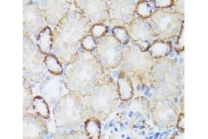 Immunohistochemistry of paraffin-embedded Mouse kidney using NEFH Polyclonal Antibody at dilution of 1:100 (40x lens). (NEFH antibody)