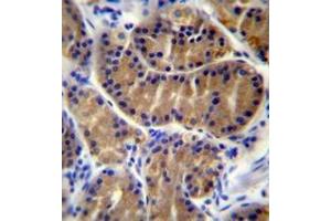 Immunohistochemistry analysis in human stomach tissue (Formalin-fixed, Paraffin-embedded) using Interleukin-17B / IL17B  Antibody , followed by peroxidase conjugation of the secondary antibody and DAB staining. (IL17B antibody  (Middle Region))