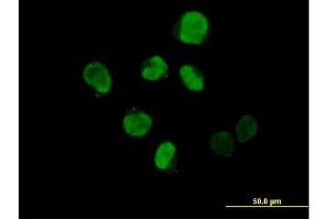 Immunofluorescence of purified MaxPab antibody to IHPK2 on HeLa cell. (IP6K2 antibody  (AA 1-426))
