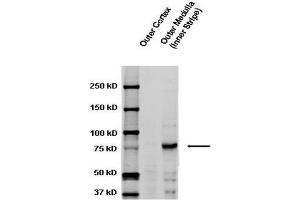 Western blot analysis of Rat kidney tissue lysates showing detection of ENaC protein using Rabbit Anti-ENaC Polyclonal Antibody . (SCNN1A antibody  (AA 629-650) (HRP))