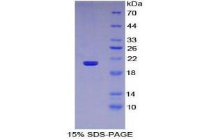 SDS-PAGE (SDS) image for Interferon, alpha 11 (IFNA11) (AA 24-190) protein (His tag) (ABIN1981258)
