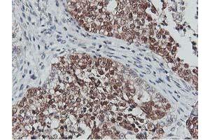 Image no. 5 for anti-CoA Synthase (COASY) antibody (ABIN1497556) (COASY antibody)