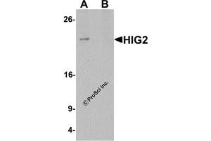 Western Blotting (WB) image for anti-Hypoxia Inducible Lipid Droplet-Associated (HILPDA) (C-Term) antibody (ABIN1030425) (HILPDA antibody  (C-Term))