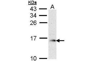 WB Image Sample (30 ug of whole cell lysate) A: Raji 15% SDS PAGE antibody diluted at 1:1000 (GMFB antibody)