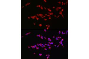 Immunofluorescence analysis of SH-SY5Y cells using GRIN2B Rabbit pAb (ABIN3017275, ABIN3017276, ABIN3017277 and ABIN1680110) at dilution of 1:100 (40x lens). (GRIN2B antibody  (C-Term))