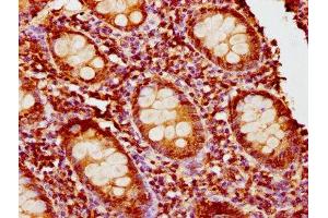 IHC image of ABIN7163299 diluted at 1:400 and staining in paraffin-embedded human appendix tissue performed on a Leica BondTM system. (PIK3R6 antibody  (Regulatory Subunit 6))