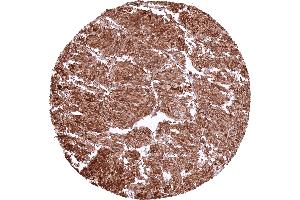 anti-Tyrosine Hydroxylase (TH) (Center) antibody