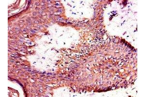 Immunohistochemistry of paraffin-embedded human skin tissue using ABIN7172328 at dilution of 1:100 (TANK antibody  (AA 4-98))