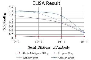 Red: Control Antigen (100 ng), Purple: Antigen (10 ng), Green: Antigen (50 ng), Blue: Antigen (100 ng), (FUK antibody)