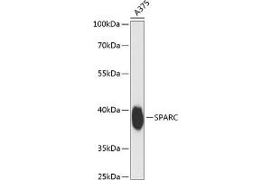 Western blot analysis of extracts of  cells, using SPARC antibody (ABIN7270183) at 1:3000 dilution. (SPARC antibody  (AA 18-303))