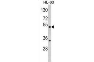 Western Blotting (WB) image for anti-Nuclear Receptor Subfamily 1, Group I, Member 2 (NR1I2) antibody (ABIN3003863) (NR1I2 antibody)