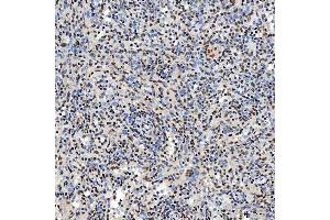 IHC analysis of SNRNP40 using anti-SNRNP40 antibody (ABIN7601719).