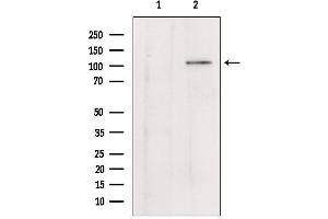 Western blot analysis of extracts from mouse lung, using Klotho Antibody.