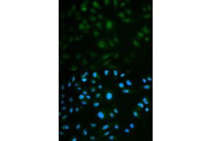 Immunofluorescence analysis of MCF7 cell using IL23R antibody. (IL23R antibody  (AA 405-629))