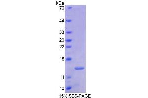 SDS-PAGE (SDS) image for Retinoic Acid Receptor, alpha (RARA) (AA 68-173) protein (His tag) (ABIN6236712) (Retinoic Acid Receptor alpha Protein (AA 68-173) (His tag))