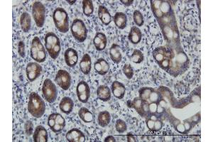 Immunoperoxidase of monoclonal antibody to ZNF259 on formalin-fixed paraffin-embedded human small Intestine. (ZNF259 antibody  (AA 361-459))