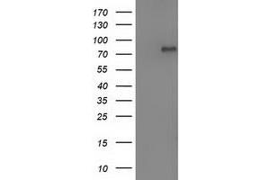 HEK293T cells were transfected with the pCMV6-ENTRY control (Left lane) or pCMV6-ENTRY OSBPL11 (Right lane) cDNA for 48 hrs and lysed. (OSBPL11 antibody)