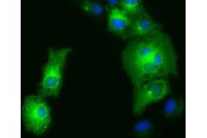 Image no. 2 for anti-Golgi Reassembly Stacking Protein 1, 65kDa (GORASP1) antibody (ABIN1498489)