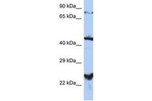 MRS2 Antikörper  (AA 215-264)