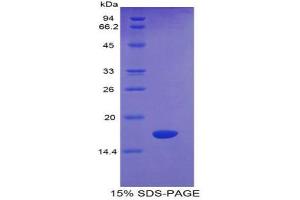 SDS-PAGE (SDS) image for Sema Domain, Immunoglobulin Domain (Ig), Transmembrane Domain (TM) and Short Cytoplasmic Domain, (Semaphorin) 4D (SEMA4D) (AA 502-636) protein (His tag) (ABIN1980938)