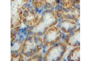#VALUE! (CHD3 antibody  (AA 1551-1742))