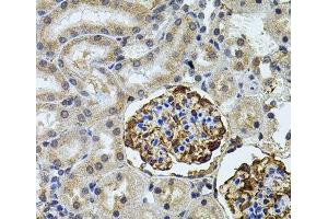 Immunohistochemistry of paraffin-embedded Rat kidney using CETP Polyclonal Antibody (CETP antibody)