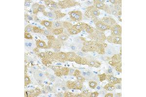 Immunohistochemistry of paraffin-embedded human liver using VEGFB Rabbit pAb (ABIN7271298) at dilution of 1:150 (40x lens). (VEGFB antibody  (AA 25-207))