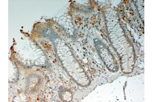 ABIN190760 (4µg/ml) staining of paraffin embedded Human Colon. (IL12B antibody  (Internal Region))