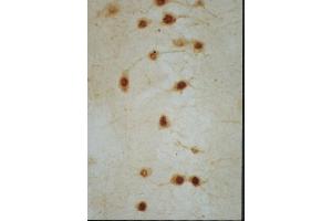 Frozen mouse hippocampus tissue labeled with Anti-Nurr1 Polyclonal Antibody, Unconjugated (ABIN725915) followed by conjugation to the secondary antibody (NR4A2 antibody  (AA 301-400))