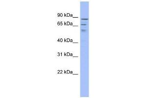 C1orf25 antibody used at 0. (TRMT1L antibody  (Middle Region))
