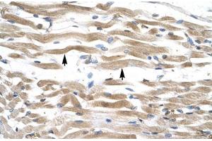 Immunohistochemical staining (Formalin-fixed paraffin-embedded sections) of human muscle with KIFC2 polyclonal antibody . (KIFC2 antibody  (AA 150-199))