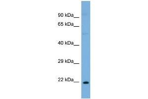 Host:  Rabbit  Target Name:  ST8SIA1  Sample Type:  OVCAR-3 Whole cell lysates  Antibody Dilution:  1. (ST8SIA1 antibody  (N-Term))