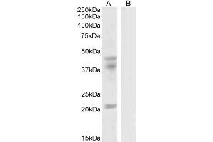 ABIN190778 (0. (GABPB2 antibody  (Internal Region))