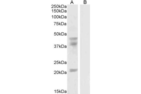 GABPB2 antibody  (Internal Region)