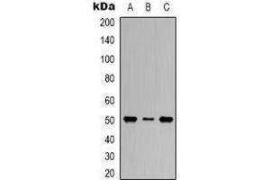 Western blot analysis of Beta1-tubulin expression in Hela (A), mouse brain (B), rat brain (C) whole cell lysates. (TUBB antibody)