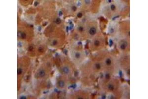 Used in DAB staining on fromalin fixed paraffin-embedded Liver tissue (SAA antibody  (AA 20-122))