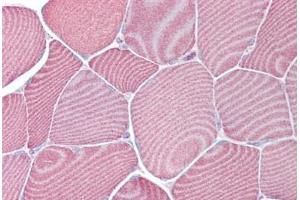 Anti-FABP3 antibody IHC staining of human skeletal muscle.