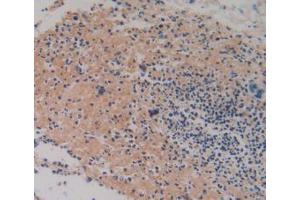 Immunohistochemistry (IHC) image for anti-Prothrombin Fragment 1+2 (F1+2) (AA 44-327) antibody (ABIN1173462)