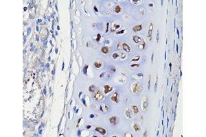 Immunohistochemistry of paraffin-embedded Rat trachea using COMP Polyclonal Antibody at dilution of 1:100 (40x lens). (COMP antibody)