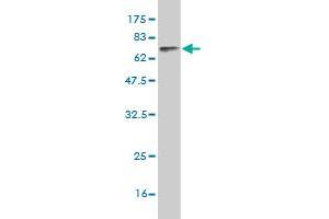 Western Blotting (WB) image for anti-Transforming Growth Factor beta 1 Induced Transcript 1 (TGFB1I1) (AA 1-444) antibody (ABIN563174)