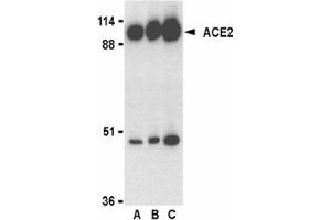 Image no. 2 for anti-Angiotensin I Converting Enzyme 2 (ACE2) (C-Term) antibody (ABIN203702) (ACE2 antibody  (C-Term))
