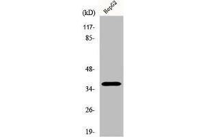 Western Blot analysis of Jurkat cells using Ephrin-A3 Polyclonal Antibody