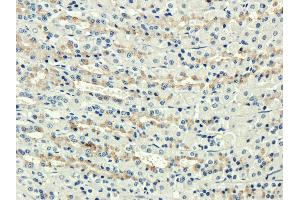 Immunohistochemical staining of rat stomach using anti-Complement receptors 1&2 antibody  Formalin fixed rat stomach slices were were stained with  at 3 µg/ml. (Recombinant Complement Receptor 1 & 2 antibody)