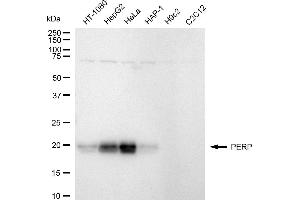 Western blotting analysis using PERP antibody (ABIN7800577). (Recombinant PERP antibody)